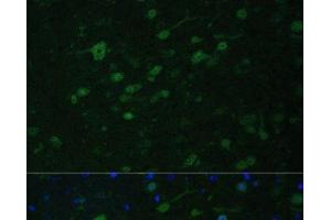 Immunofluorescence analysis of Mouse brain using KMT2E Polyclonal Antibody at dilution of 1:100. (MLL5/KMT2E Antikörper)