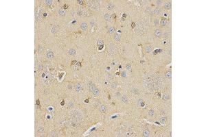 Immunohistochemistry (IHC) image for anti-Carboxypeptidase E (CPE) antibody (ABIN1876646) (CPE Antikörper)