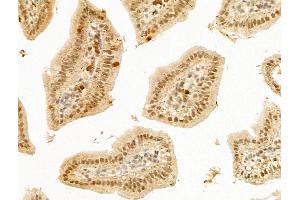 ABIN7094900 and ABIN7098953 at 1/100 staining Mouse colorectal tissue by IHC-P. (LHX6 Antikörper  (Internal Region))