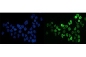 IF analysis of splicing factor 1 using anti-splicing factor 1 antibody (ABIN7600193).