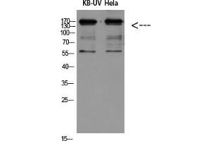 Western Blot (WB) analysis of KB-UV HeLa using Integrin beta2 Polyclonal Antibody diluted at 1:500.