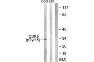 Western blot analysis of extracts from COS7 cells treated with EGF 200ng/ml 30' and 293 cells treated with H2O2 100u, 15mins, using CDK5 (Phospho-Tyr15) Antibody. (CDK5 Antikörper  (pTyr15))