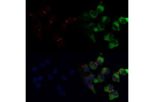 ABIN6266146 and ABIN6268691 staining  by IF/ICC. (TJP1 Antikörper  (Internal Region))