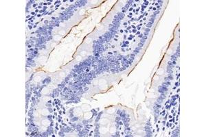 Immunohistochemistry analysis of paraffin-embedded rat duodenum using,SLC22A1 (ABIN7075663) at dilution of 1: 1200 (SLC22A1 Antikörper)
