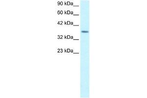 RPS16 antibody (20R-1083) used at 5 ug/ml to detect target protein. (RPS16 Antikörper  (Middle Region))