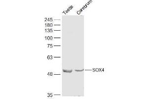 Lane 1: Mouse Testis lysates Lane 2: Mouse Cerebrum lysates probed with SOX4 Polyclonal Antibody, Unconjugated  at 1:500 dilution and 4˚C overnight incubation. (SOX4 Antikörper  (AA 54-103))