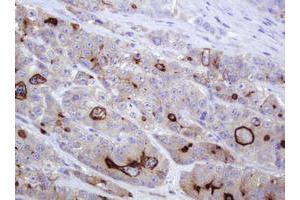 Image no. 2 for anti-ATP-Binding Cassette, Sub-Family B (MDR/TAP), Member 1 (ABCB1) (AA 347-710) antibody (ABIN1491433) (ABCB1 Antikörper  (AA 347-710))