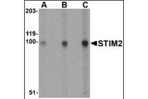 Western blot analysis of STIM2 in A-20 cell lysate with this product at (A) 0. (Stim2 Antikörper  (Center))