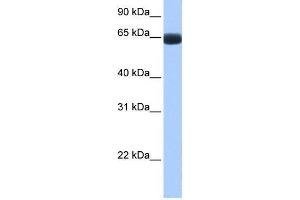 Human Lung; WB Suggested Anti-ARHGAP28 Antibody Titration: 0. (ARHGAP28 Antikörper  (C-Term))