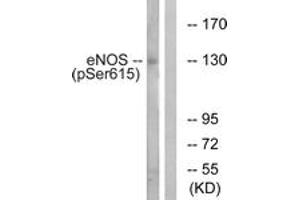 Western blot analysis of extracts from K562 cells treated with EGF 40nM 30', using eNOS (Phospho-Ser615) Antibody. (ENOS Antikörper  (pSer615))