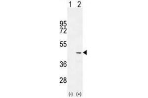 Western blot analysis of COCH (arrow) using rabbit polyclonal COCH Antibody (C-term) . (COCH Antikörper  (C-Term))