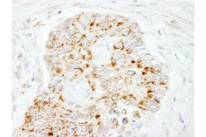 Immunohistochemistry (IHC) image for anti-Mitochondrial Antiviral Signaling Protein (MAVS) (AA 150-200) antibody (ABIN7455082)