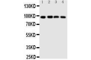 Anti-SIDT1 antibody, Western blotting Lane 1: HELA Cell Lysate Lane 2: COLO320 Cell Lysate Lane 3: SW620 Cell Lysate Lane 4:  Cell Lysate (SIDT1 Antikörper  (N-Term))