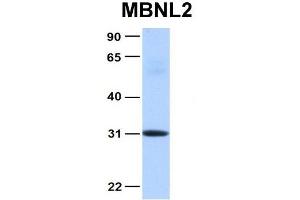 Host:  Rabbit  Target Name:  MBNL2  Sample Type:  Human Fetal Heart  Antibody Dilution:  1. (MBNL2 Antikörper  (Middle Region))