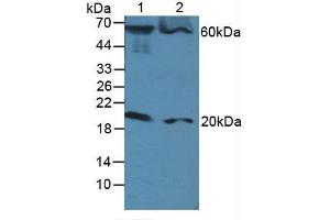 Figure. (FADD Antikörper  (AA 12-206))