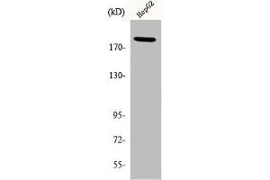 Western Blot analysis of HepG2 cells using Phospho-IRS-1 (S312) Polyclonal Antibody (IRS1 Antikörper  (pSer312))