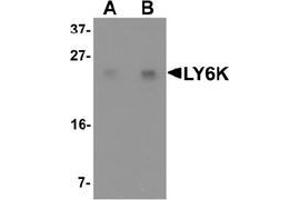 Western blot analysis of LY6K in HeLa cell lysate with LY6K Antibody  at (A) 1 and (B) 2 μg/ml. (Ly6k Antikörper  (N-Term))