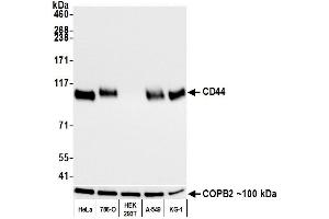 Western Blotting (WB) image for anti-CD44 (CD44) (AA 700-742) antibody (ABIN7454002) (Rekombinanter CD44 Antikörper  (AA 700-742))