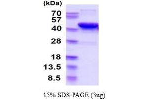 SDS-PAGE (SDS) image for Sirtuin 6 (SIRT6) (AA 1-355) protein (His tag) (ABIN666639)