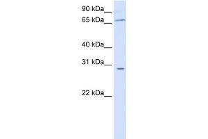 WB Suggested Anti-ZBTB48 Antibody Titration: 0. (ZBTB48 Antikörper  (N-Term))
