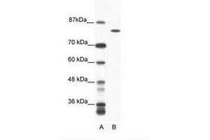 Image no. 1 for anti-DEAH (Asp-Glu-Ala-His) Box Polypeptide 16 (DHX16) (AA 352-401) antibody (ABIN6736054) (DHX16 Antikörper  (AA 352-401))