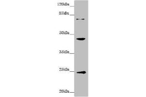 Western blot All lanes: GNA15 antibody at 1. (GNA15 Antikörper  (AA 1-374))
