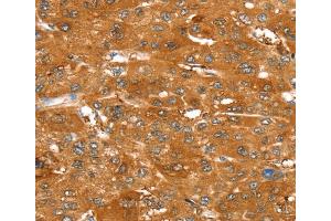Immunohistochemistry (IHC) image for anti-ATP-Binding Cassette, Sub-Family C (CFTR/MRP), Member 9 (ABCC9) antibody (ABIN2433955) (ABCC9 Antikörper)