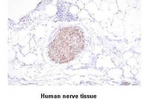 Paraffin embedded sections of human nerve tissue were initrocelluloseubated with anti-human PGP9.