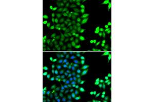 Immunofluorescence analysis of MCF-7 cells using RNF7 antibody (ABIN4905022). (RNF7 Antikörper)