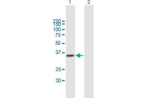 Western Blot analysis of TREX1 expression in transfected 293T cell line by TREX1 MaxPab polyclonal antibody. (TREX1 Antikörper  (AA 1-304))