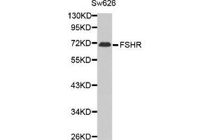 Western blot analysis of extracts of Sw626 cell line,using FSHR antibody. (FSHR Antikörper)