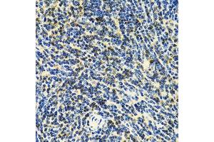 Immunohistochemistry (Paraffin-embedded Sections) (IHC (p)) image for anti-CD3 epsilon (CD3E) (AA 25-207) antibody (ABIN3022492)