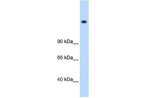 WB Suggested Anti-MED16 Antibody Titration: 0. (MED16 Antikörper  (N-Term))