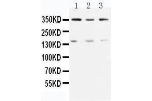 Anti-ATM antibody, Western blotting Lane 1: Rat Testis Tissue Lysate Lane 2: U87 Cell Lysate Lane 3: MCF-7 Cell Lysate (ATM Antikörper  (N-Term))