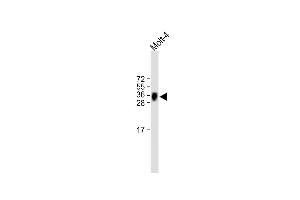 All lanes : Anti-TRBC1 Antibody (Center) at 1:500 dilution Lane 1: Molt-4 whole cell lysate Lysates/proteins at 20 μg per lane. (TRBC1 Antikörper  (AA 104-136))