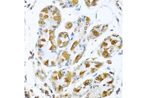 Immunohistochemistry of paraffin-embedded human stomach using PI antibody (ABIN6128452, ABIN6145599, ABIN6145601 and ABIN6222851) at dilution of 1:100 (40x lens). (PIAS3 Antikörper  (AA 452-628))