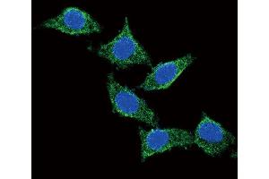 Confocal immunofluorescent analysis of ADCY Antibody (C-term) (ABIN651855 and ABIN2840424) with 293 cell followed by Alexa Fluor? (PACAP Antikörper  (C-Term))