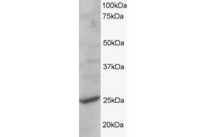 ABIN184844 staining (1µg/ml) of human liver lysate (RIPA buffer, 35µg total protein per lane). (CYB561D2 Antikörper  (C-Term))