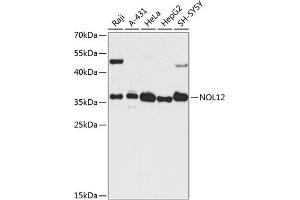 Western blot analysis of extracts of various cell lines, using NOL12 antibody  at 1:3000 dilution. (NOL12 Antikörper  (AA 1-213))