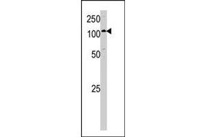 Western blot analysis of HK1 polyclonal antibody  in A-375 cell lysate. (Hexokinase 1 Antikörper  (C-Term))