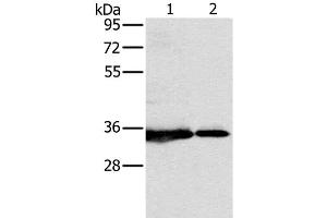 Western Blot analysis of 231 and Jurkat cell using NDUFAF1 Polyclonal Antibody at dilution of 1:500