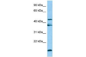 WB Suggested Anti-LGMN Antibody Titration: 1. (LGMN Antikörper  (Middle Region))