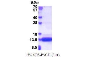 SDS-PAGE (SDS) image for Chondrosarcoma Associated Gene 1 (CSAG1) (AA 20-78) protein (His tag) (ABIN5853657)