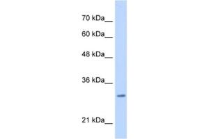 Western Blotting (WB) image for anti-Myeloid Leukemia Factor 2 (MLF2) antibody (ABIN2462989) (MLF2 Antikörper)