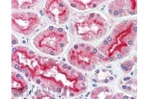 Immunohistochemistry (IHC) image for anti-ArfGAP with GTPase Domain, Ankyrin Repeat and PH Domain 3 (AGAP3) (C-Term) antibody (ABIN185100)
