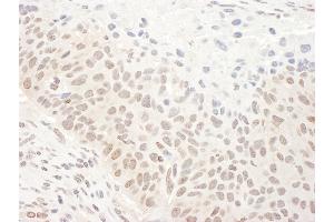anti-DEAH (Asp-Glu-Ala-His) Box Polypeptide 33 (DHX33) (AA 1-50) antibody
