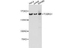 Western blot analysis of extracts of various cell lines, using TCERG1 antibody. (TCERG1 Antikörper)