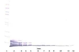 Image no. 1 for anti-Chemokine (C-X-C Motif) Ligand 6 (CXCL6) antibody (ABIN464969) (CXCL6 Antikörper)