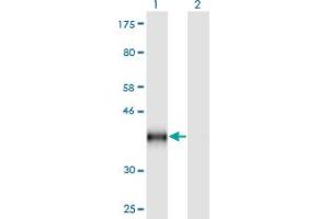 Western Blot analysis of CD59 expression in transfected 293T cell line by CD59 monoclonal antibody (M02), clone 3G6.