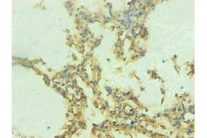 Immunohistochemical of paraffin-embedded human lung tissue using ABIN7168560 at dilution of 1:200 (S1A9 Antikörper)